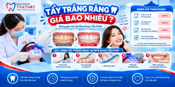 Tẩy Trắng Răng Giá Bao Nhiêu? Bảng Giá Mới Tại Nha Khoa Tấn Phát