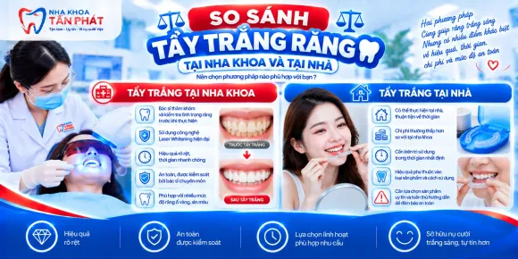 So Sánh Tẩy Trắng Răng Tại Nha Khoa Và Tẩy Trắng Răng Tại Nhà: Nên Chọn Cách Nào?